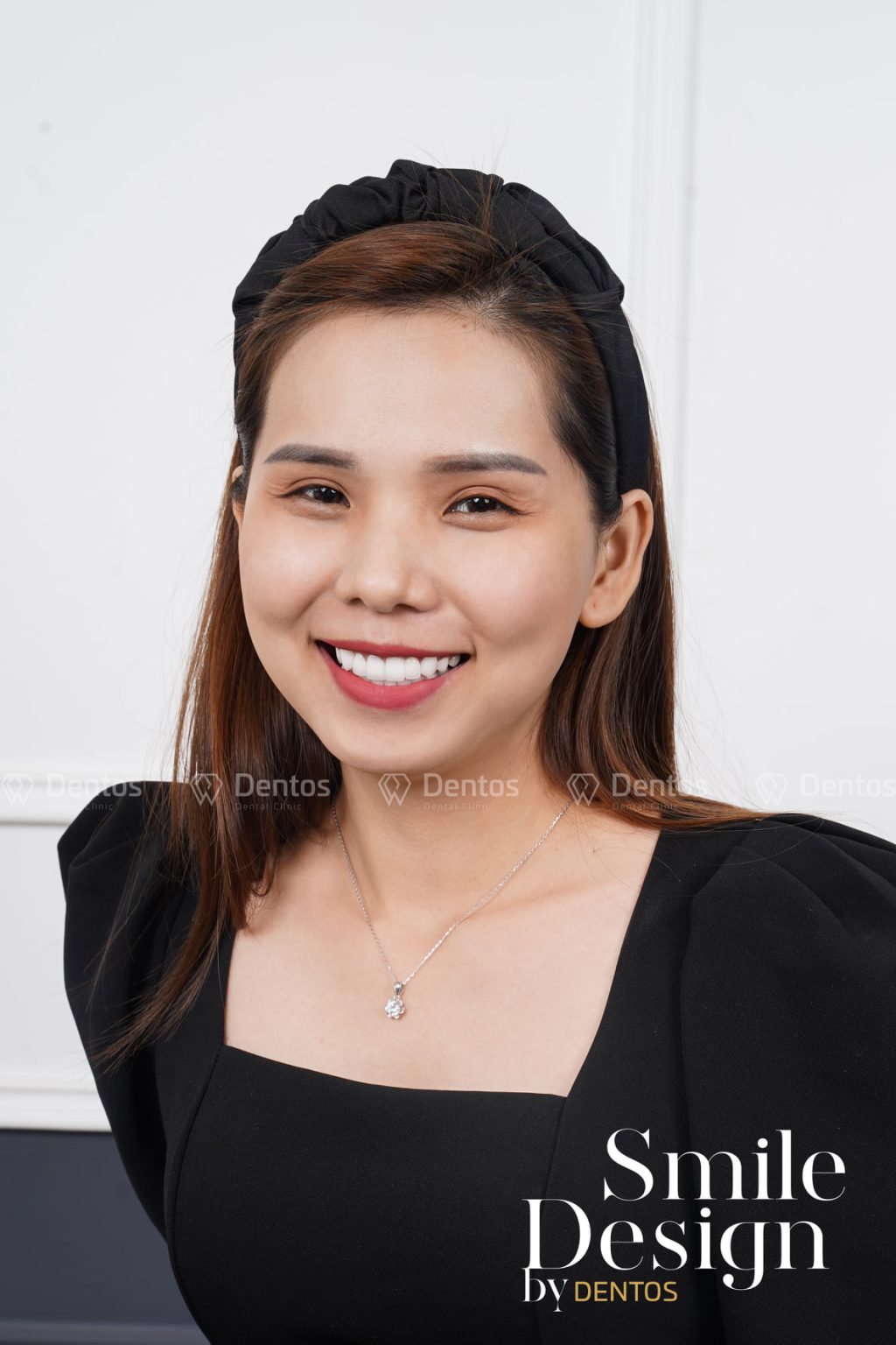 Một nụ cười đều đẹp chỉn chu lúc nào cũng toát lên sự sang trọng và thanh lịch